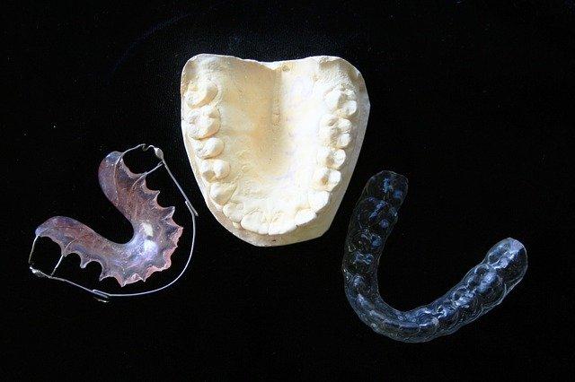 Fiksni zobni aparati imajo nekaj zanimivih alternativ